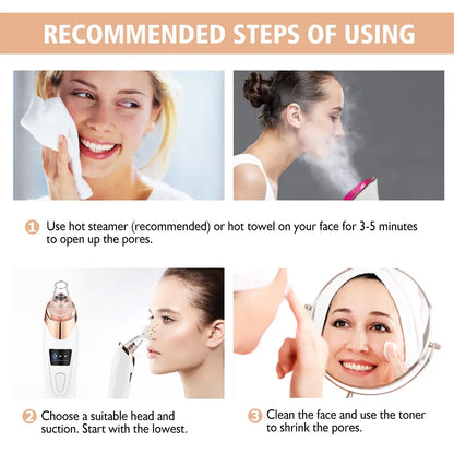 2026 Newest Blackhead Remover Pore Vacuum USB Rechargeable Blackhead Extractor with 4 Replacement Tips for Effective Skin Care Heat Compression Leg Massager Skincare Gadgets